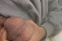 Tortinho18